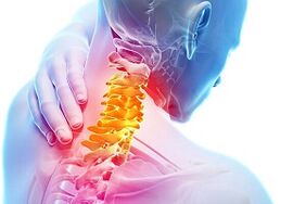 Cervical osteochondrosis symptoms and nutritional rules for disease