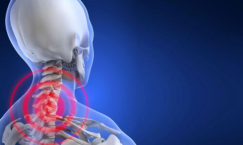 cervical spine osteochondrosis